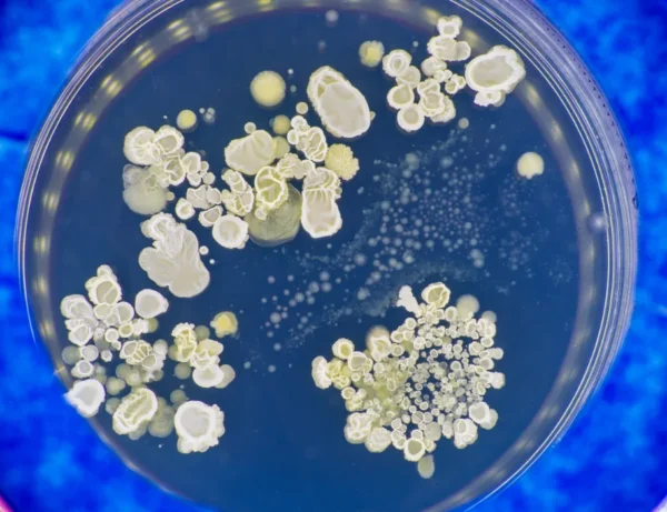 fungus in a petri dish