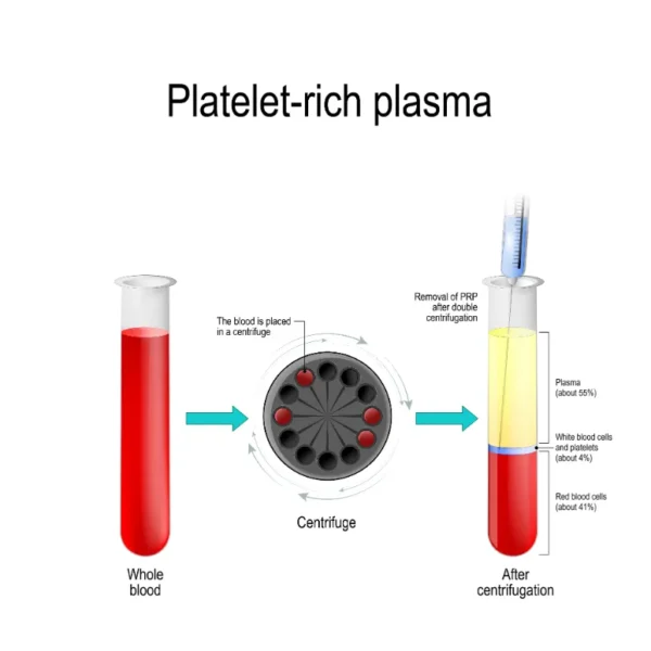 rich plasma diagram